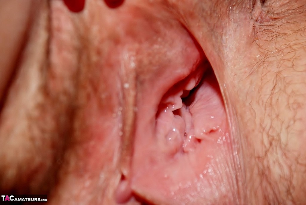 An amateur athlete with a busy body creams her pustule in a closeup.