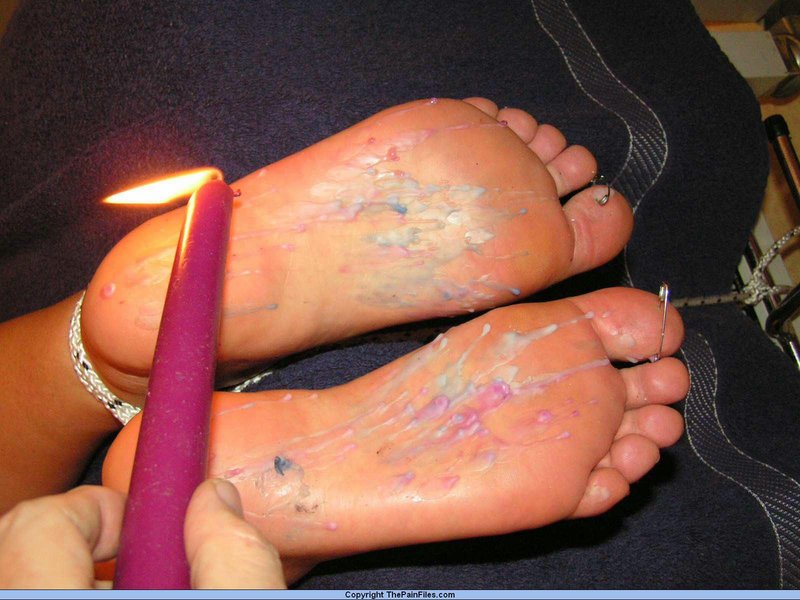 The Pain Files applied hot candle wax to the feet.