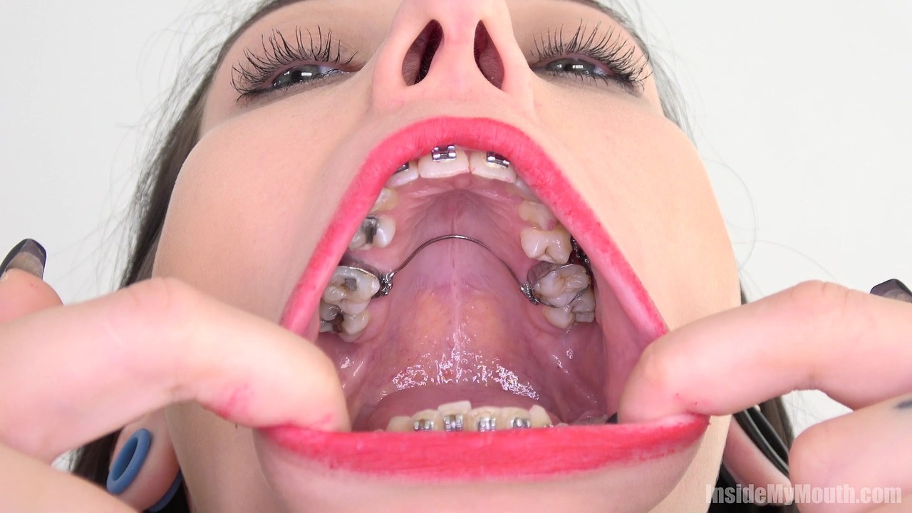 Brunette with dental braces opens wide for close up views of her big mouth foto porno #424966042 | Inside My Mouth Pics, Close Up, porno mobile
