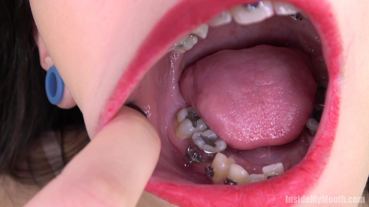 Brunette with dental braces opens wide for close up views of her big mouth porn photo #424966064