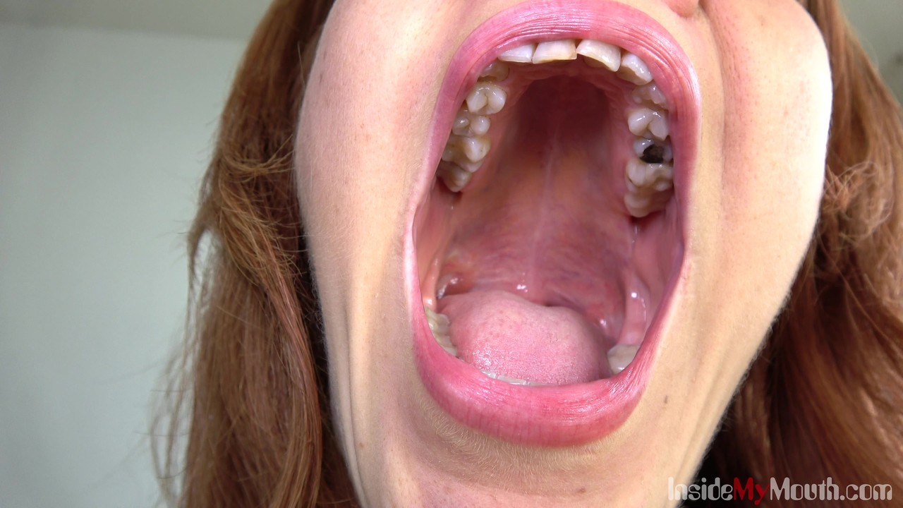 Inside My Mouth 色情照片 #426956507 | Inside My Mouth Pics, Close Up, 手机色情