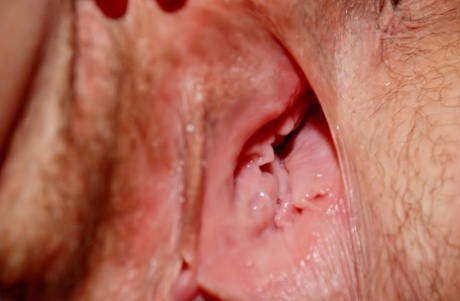 An amateur athlete with a busy body creams her pustule in a closeup.