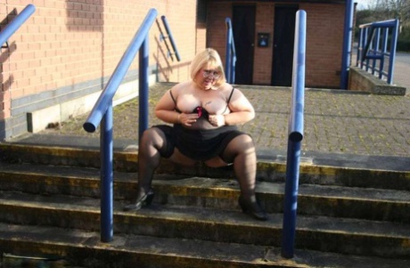 In the UK, Lexie Cummings, an obese amateur athlete, exposes her large genital area and abscesses in public.