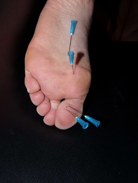 Amateur Needle Pain is available through The Pain Files.