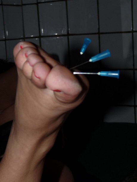 Amateur Needle Pain is available at The Pain Files.