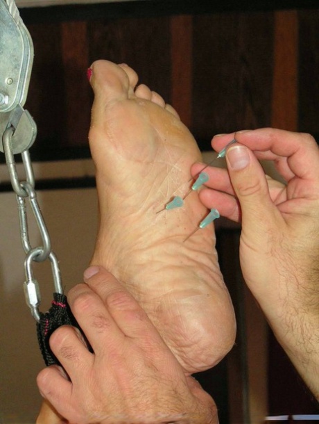 A woman who is restrained has needles inserted into her bare feet.