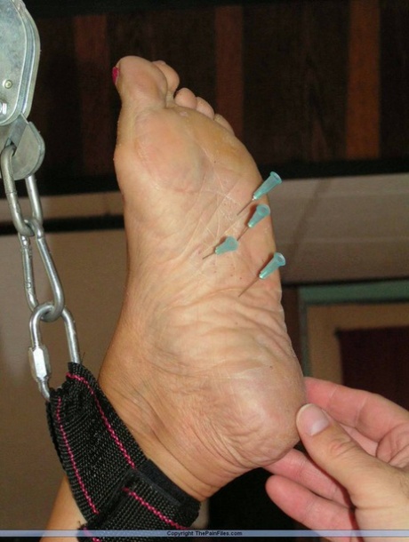 Female paralyzed with needles placed into her bare feet.