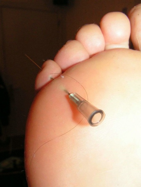 The restraining white girl has needles placed into her body parts.