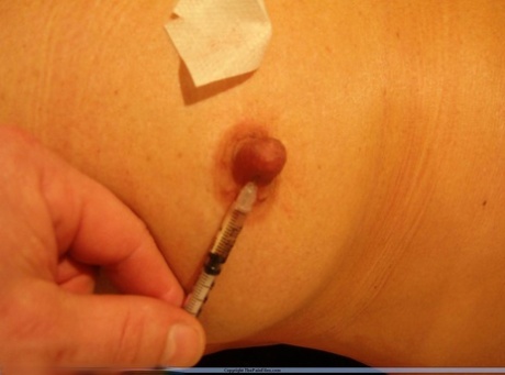 I use a website called The Pain Files to share about the amateur needle pain.