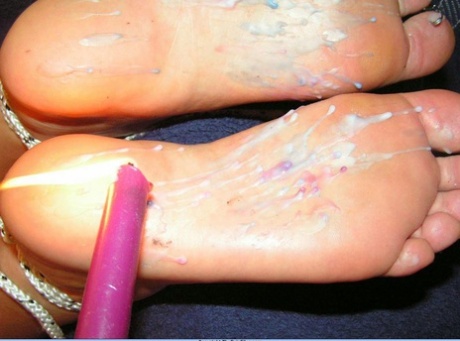 The Pain Files applied hot candle wax to the feet.