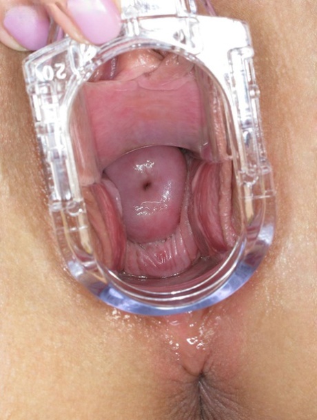 Speculum Cervix Closeup Porn Pics & Naked Photos - PornPics.com