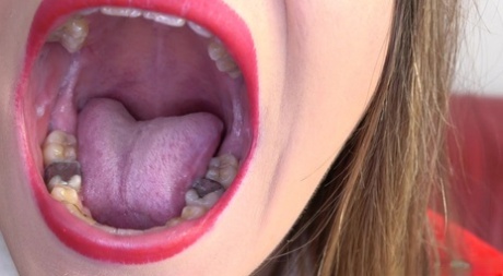 Hottie in a Xmas outfit opens her mouth & gets her teeth checked by a dentist #13